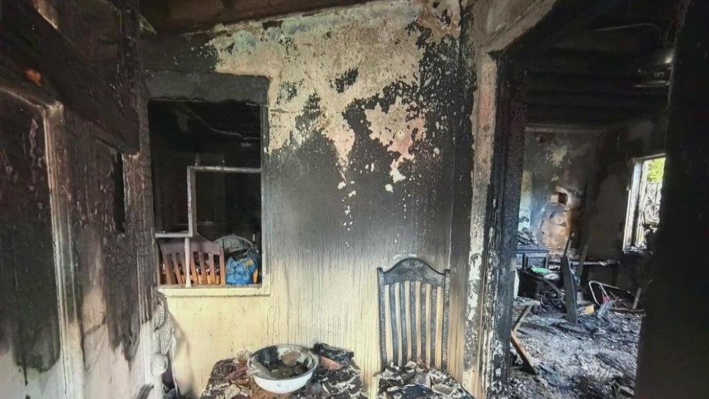Woman hospitalized after Miami house fire leaves three displaced — CBS Miami, Jupiter Health news