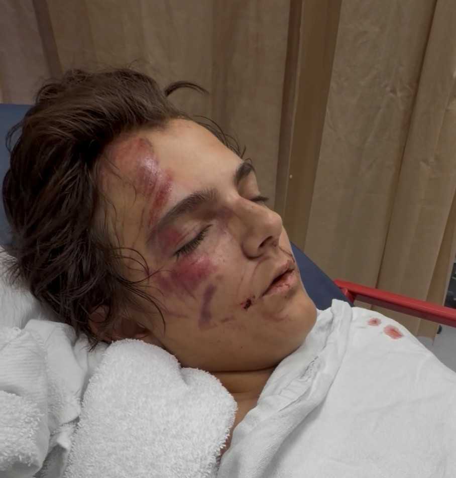 Father of boy hit by SUV in Boynton Beach urges drivers to be more careful — Jupiter Community news
