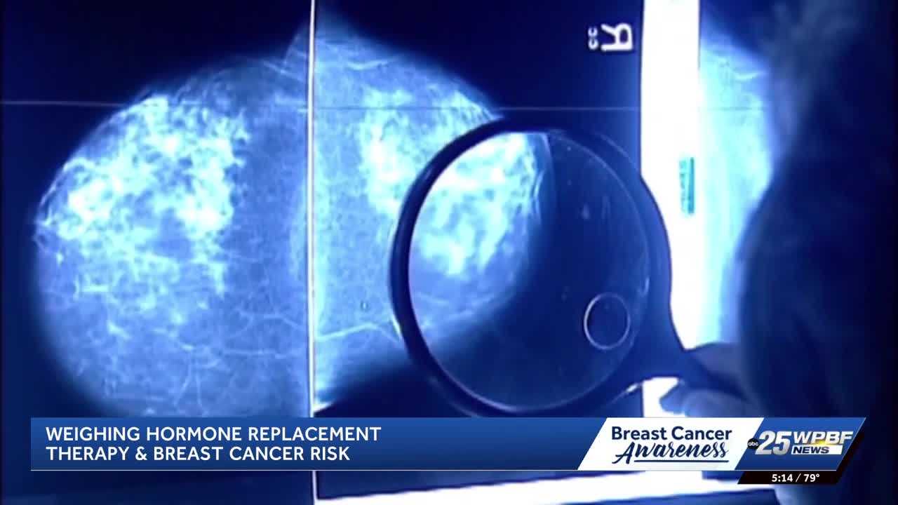 How does hormone replacement therapy affect breast cancer risk? — WPBF West Palm Beach, Jupiter Community news